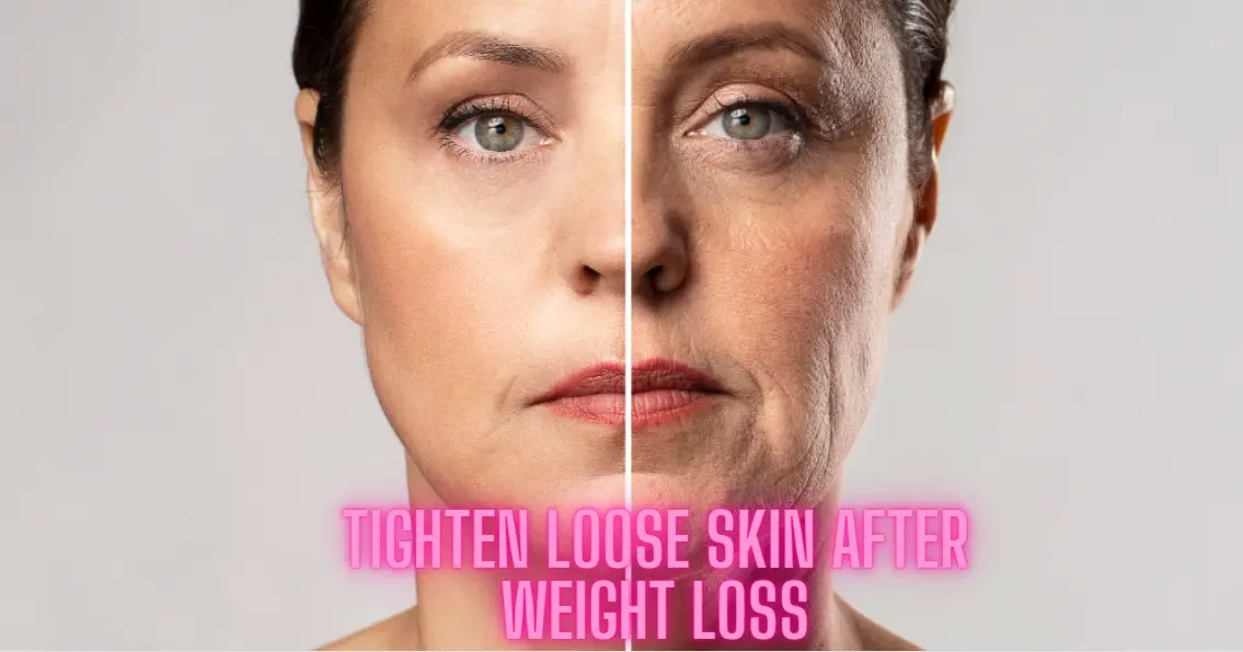 Tighten Loose Skin After Weight Loss Naturally.